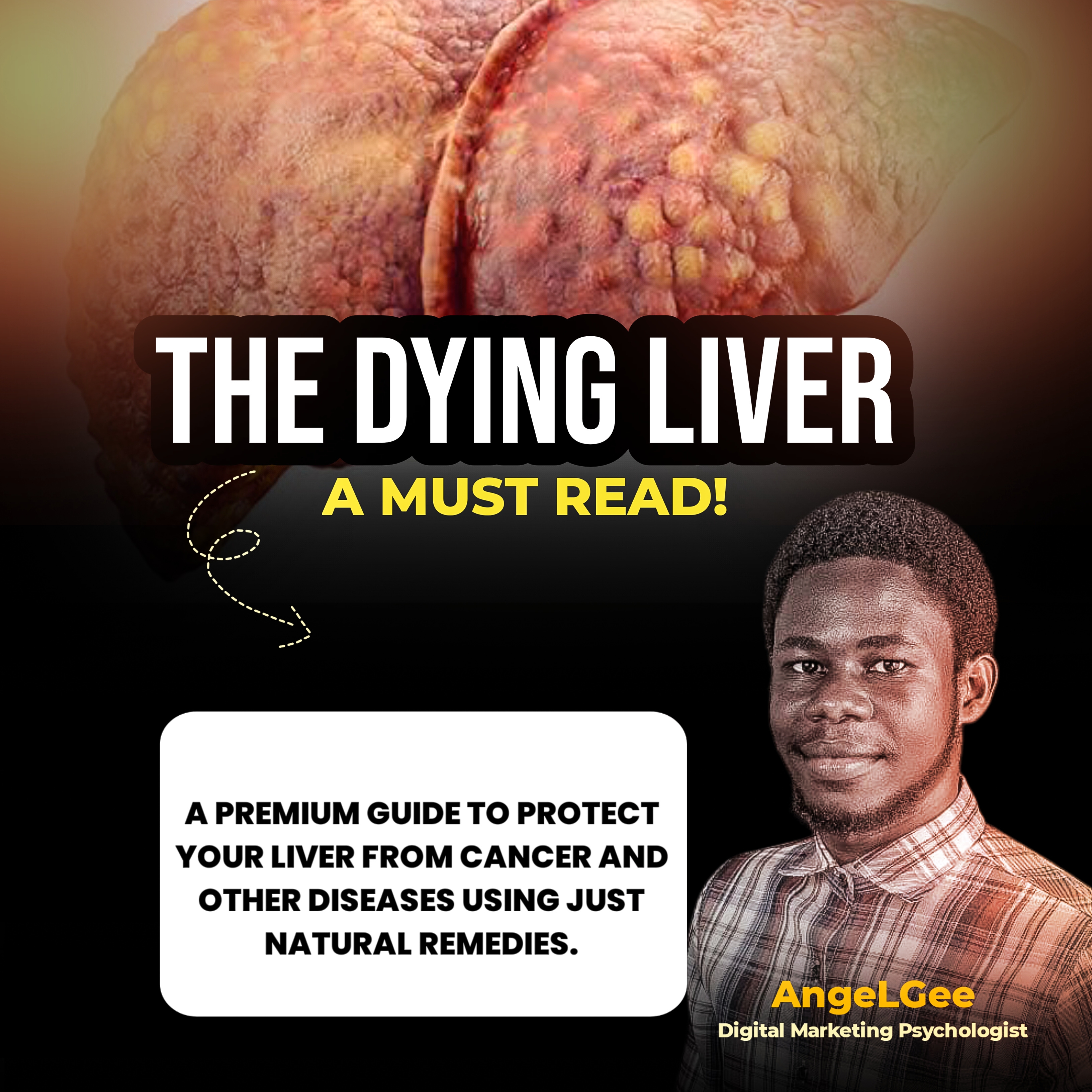 The Dying Liver - a must read!